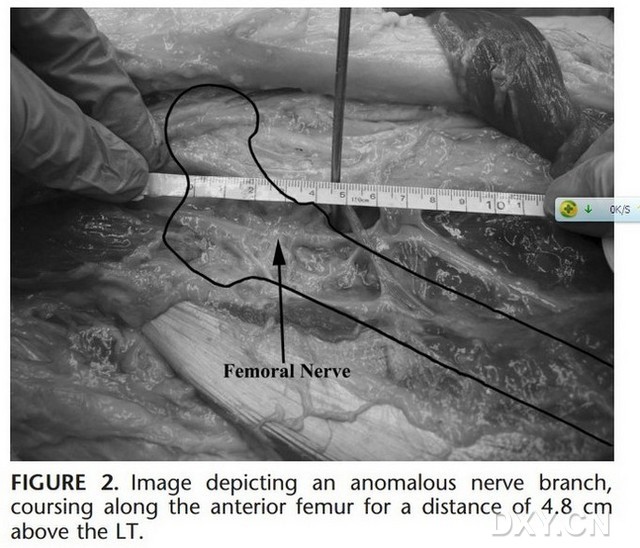 木材市场观察：巴花货源少价格上涨10%‘kaiyun网页登录入口’